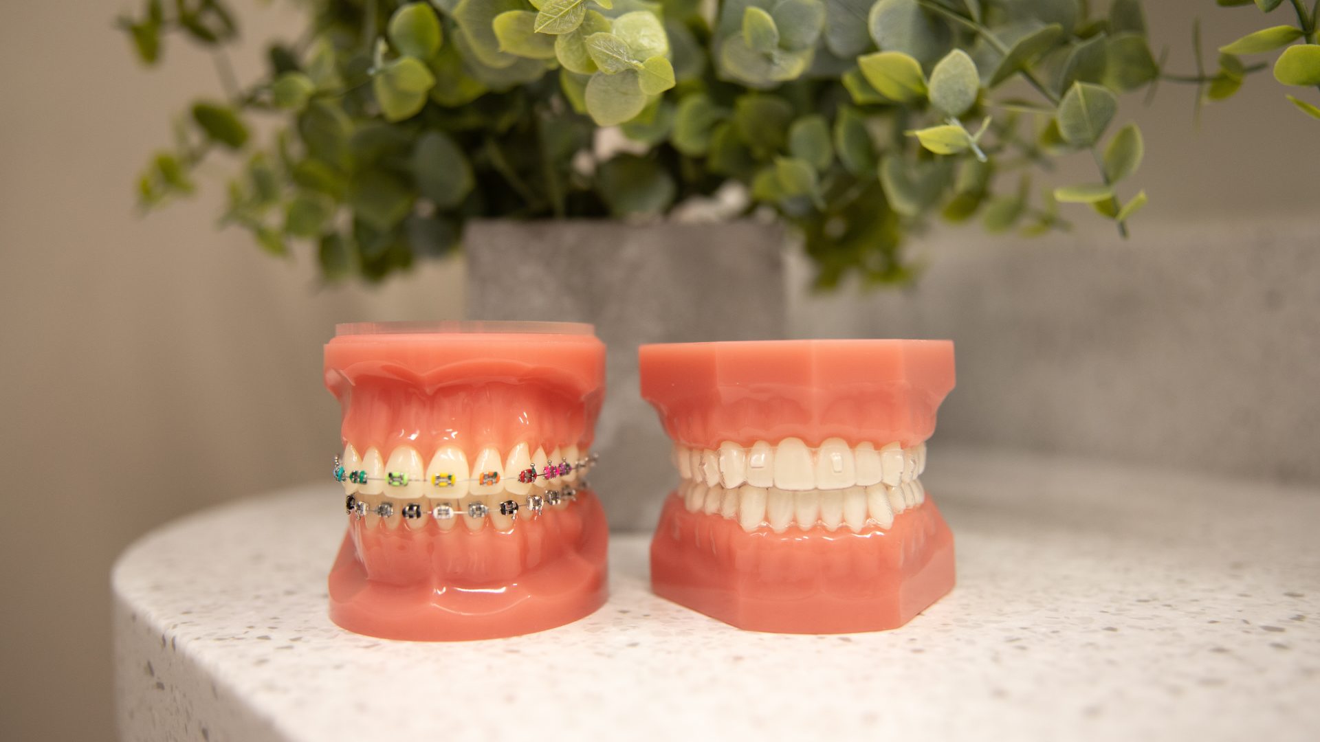 Orthodontic Models