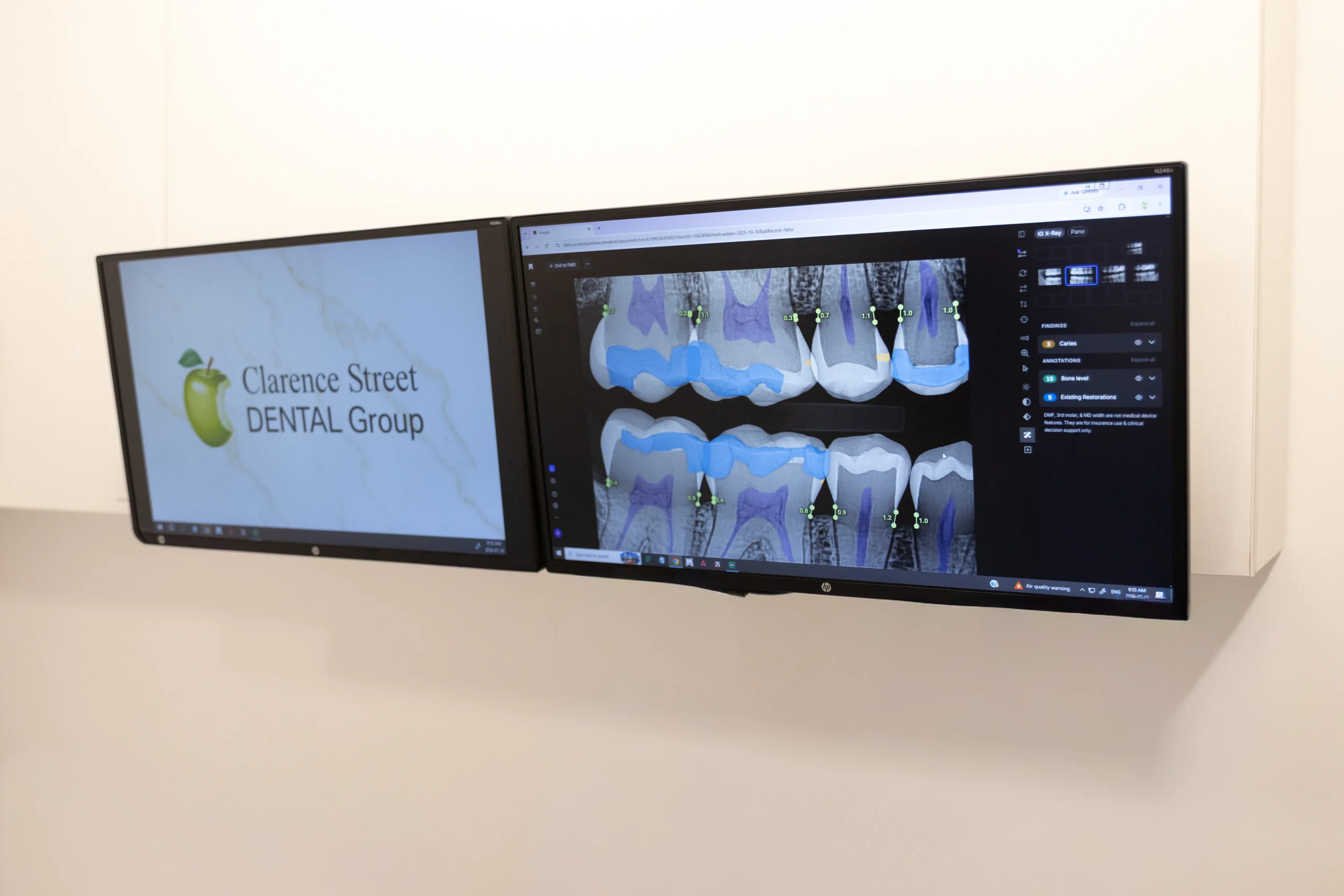The Right Way to Use AI in Dentistry