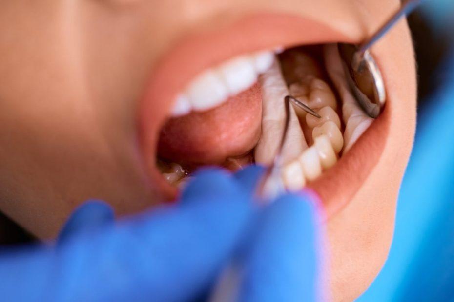 Gum Disease Treatment in Brantford